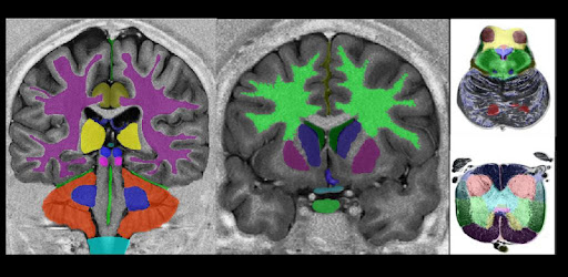 NeuroSlice -  apk apps