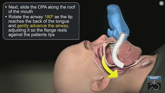 How to download Medrills: Airway Management patch 1.6 apk for bluestacks