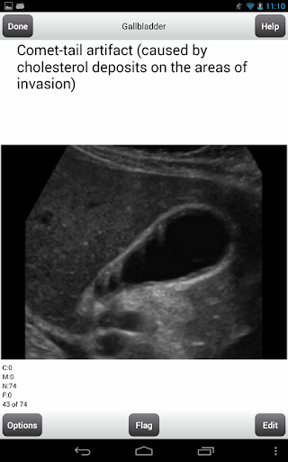 ARDMS Abdomen Ultrasound Cards