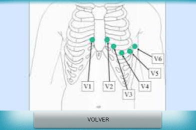 Electrocardiograma PRO poster 2