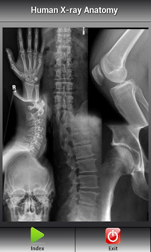 Human X-ray Anatomy
