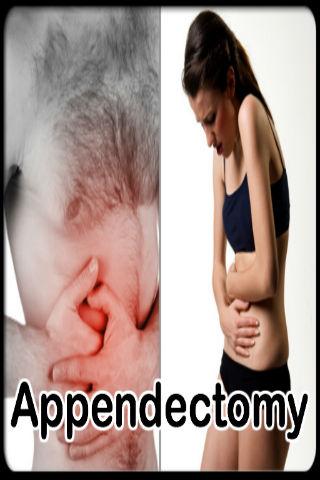 Appendectomy Treatment