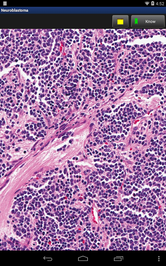 Anatomic Pathology Flashcards Android Apps on Google Play