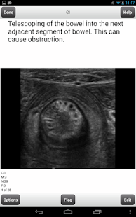 How to get ARRT Ultrasound Cards Lite patch 2.46 apk for android