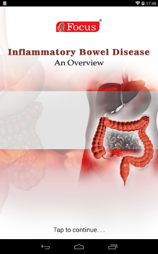 Inflammatory Bowel Disease