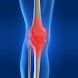 Rheumatology
