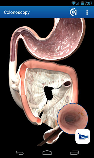 Endoscopy in Dogs