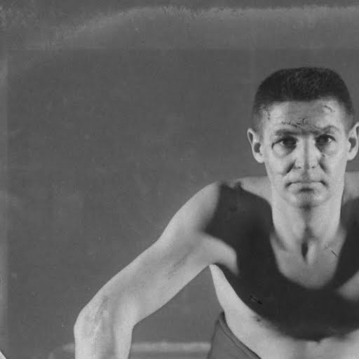 What a hockey goalie's face looked like before masks became the norm