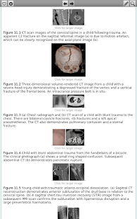 ABC of Imaging in Trauma - screenshot thumbnail