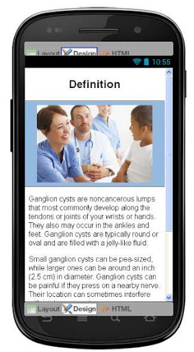 Ganglion Cyst Information