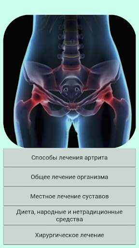 免費下載健康APP|Лечение суставов. app開箱文|APP開箱王