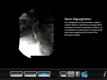 Swallowing Oral Screenshots 6