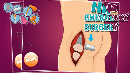 【免費模擬App】Virtual hip emergency surgery-APP點子