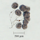 Colonial Protozoan - Carchesium