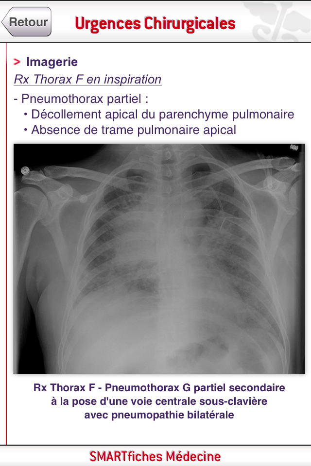 SMARTfiches Urgences Chir Screen 3