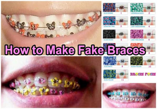 How to Make Fake Braces