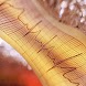 Cardiac Electrophysiology