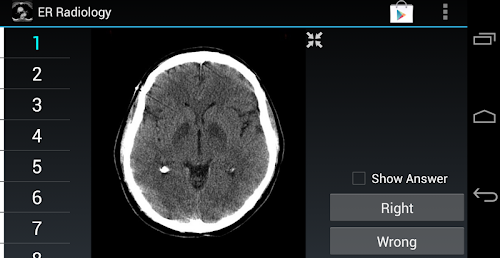 Android application Radiology Flashcards: ER screenshort