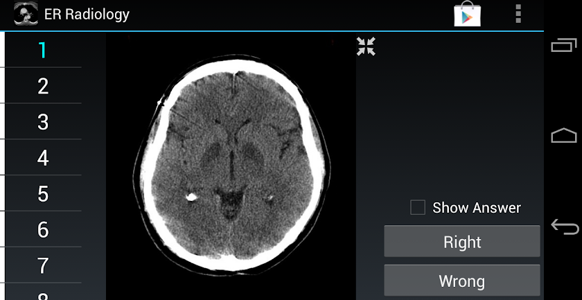 Radiology Flashcards: ER Screen 1