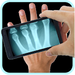 Cover Image of Download Xray Scanner Prank 1.4 APK