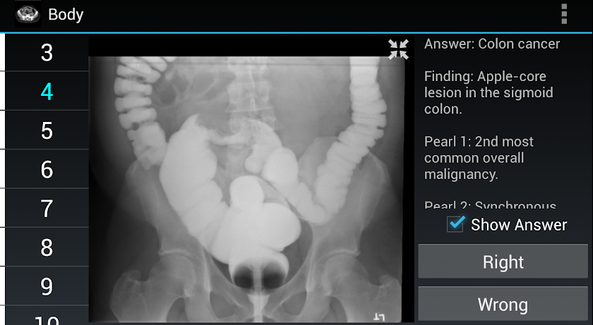 Radiology Flashcards: Body Screen 2