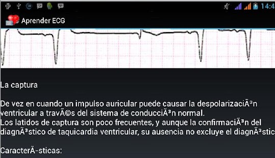 Lastest Aprender Ecg APK