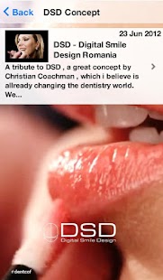 Free DSD-Digital Smile Design (en) APK for Android