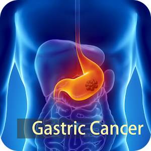 Gastric Cancer 1.0