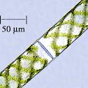 Spirogyra