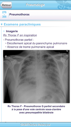 【免費醫療App】SMARTfiches Pneumologie-APP點子