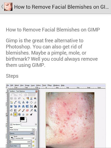 Remove Blemishes in Photo Tips