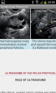 Gynecology Ultrasound Screenshots 3