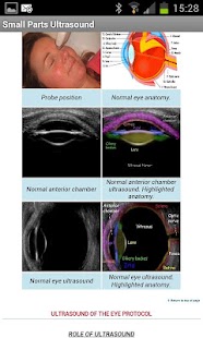 How to download Small Parts Ultrasound 1.0 unlimited apk for pc