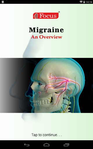 Migraine-An Overview