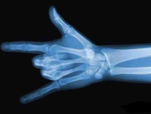 X-ray Body Scan Prank