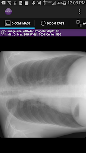 Free Mobile Dicom Viewer APK