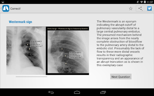 免費下載醫療APP|Chest X-Ray Training app開箱文|APP開箱王