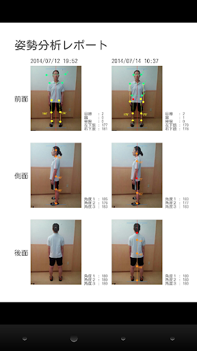 姿勢分析（からだのゆがみ分析アプリ）