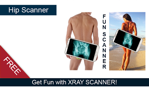 Hip X-ray Scanner Prank
