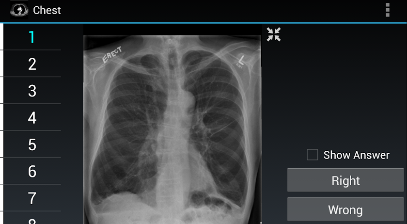 Radiology Flashcards: Chest Screen 2