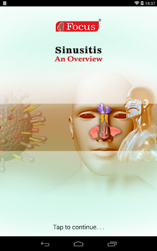 【免費醫療App】Sinusitis-APP點子