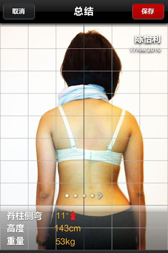 免費下載醫療APP|脊柱側彎跟踪 (ScolioTrack) app開箱文|APP開箱王