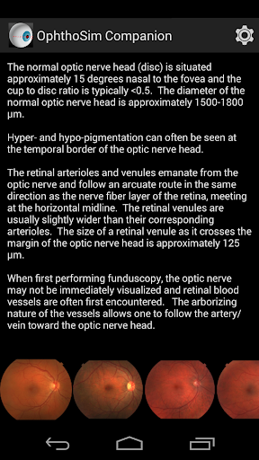 免費下載醫療APP|OphthoSim Companion app開箱文|APP開箱王