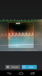 How to get Capstesia App Anesthesia 1.1.6 apk for android