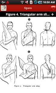 Bandaging and Splinting Screenshots 3
