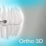 Carriere Ortho 3D Apk
