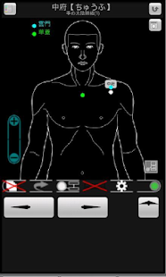 How to install Acupuncture (tentative) 3.302 mod apk for bluestacks