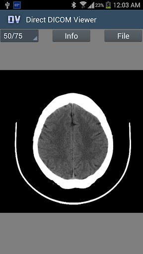 Direct DICOM Viewer