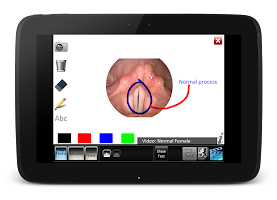 Vocal Folds ID APK צילום מסך #10