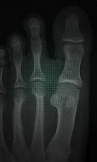 برنامج الاشعة X-ray اندرويد 2012